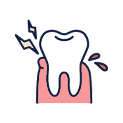 歯周病・歯肉炎・歯槽膿漏