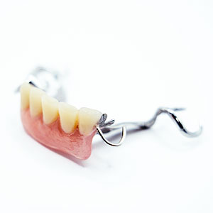 一般的な部分入れ歯